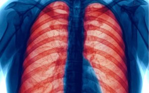 Exercise for Chronic Obstructive Pulmonary Disease Patients