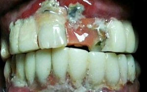 Doktor Pergigian Haram (Bogus Dentist)