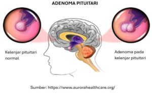 Bukan Sekadar Tangan Besar