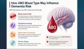 ABO Blood Type & Potential Link To Dementia Risk