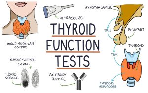 Ujian Fungsi Tiroid (Thyroid Function Test)