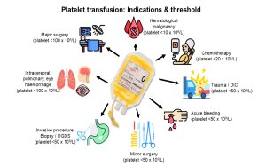 Platelet Transfusion