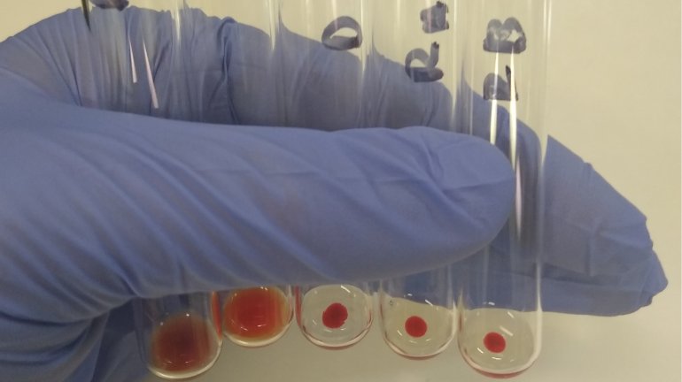 Apakah Itu ‘Blood Crossmatching’ Atau Ujian Keserasian Darah?