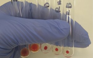 Apakah Itu ‘Blood Crossmatching’ Atau Ujian Keserasian Darah?