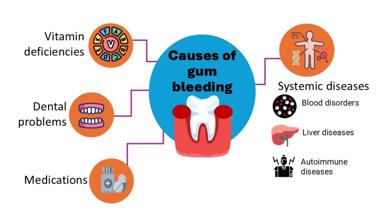 Gum Bleeding: Beyond Dental Problems