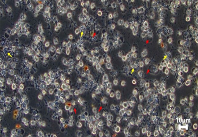 Piroptosis: Mekanisme Kematian Sel Yang Mencetuskan Keradangan