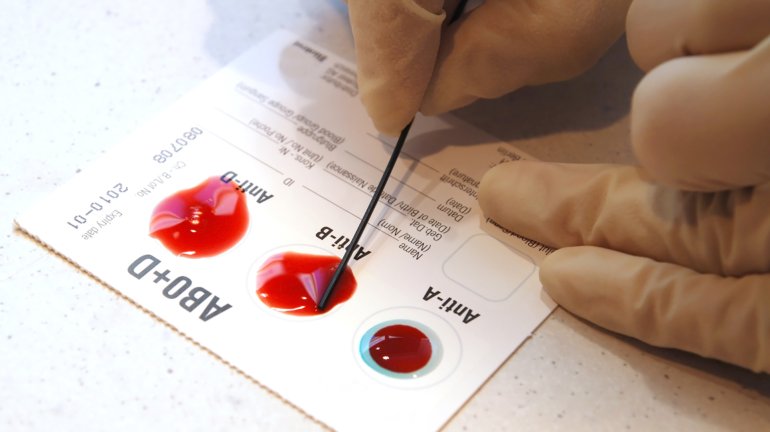 ABO Blood Grouping