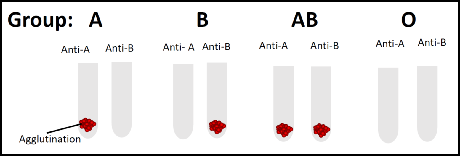 Blood Group Test In Detail Forward Grouping Reverse 53 OFF